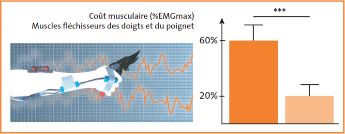 exemple