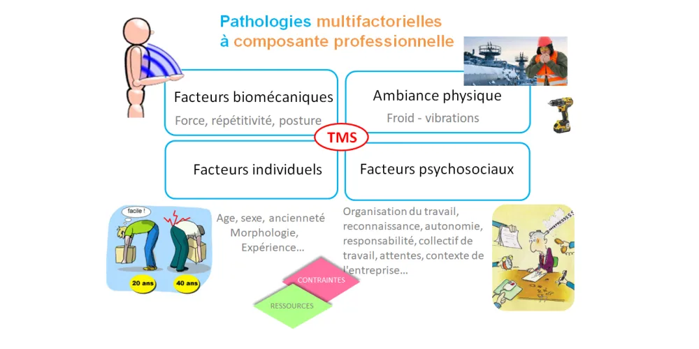 Les TMS, des pathologies multifactorielles à composante professionnelle